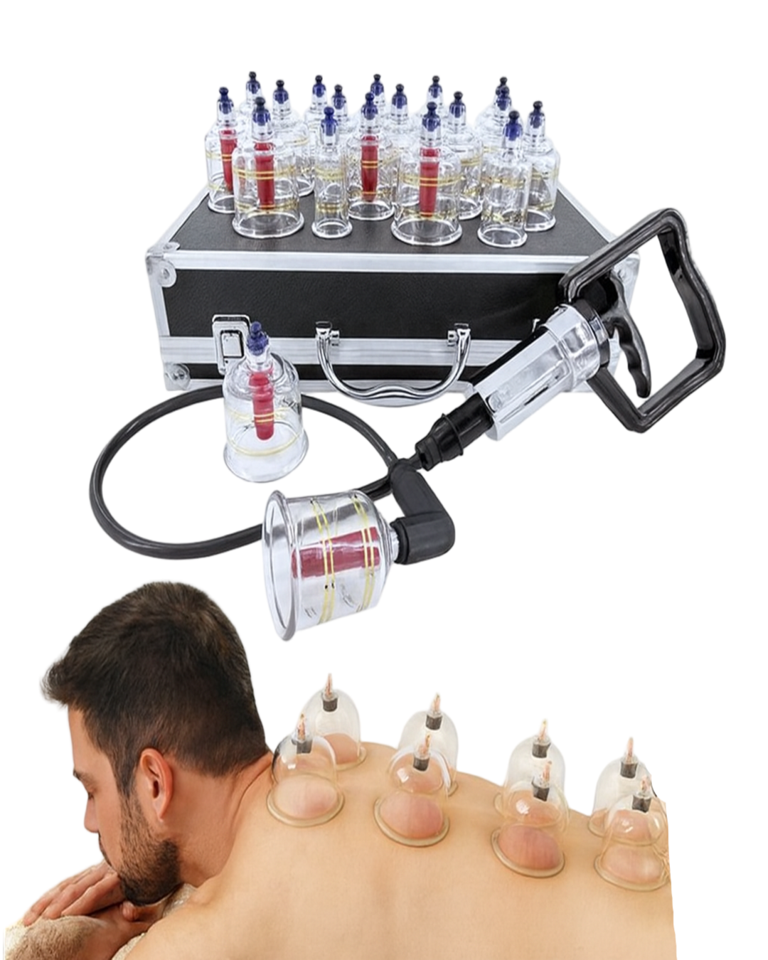 Coffret de Ventouses / Hijama